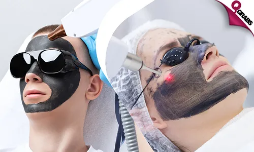 Carbon Laser + Bleaching at United Care Medical Center!
